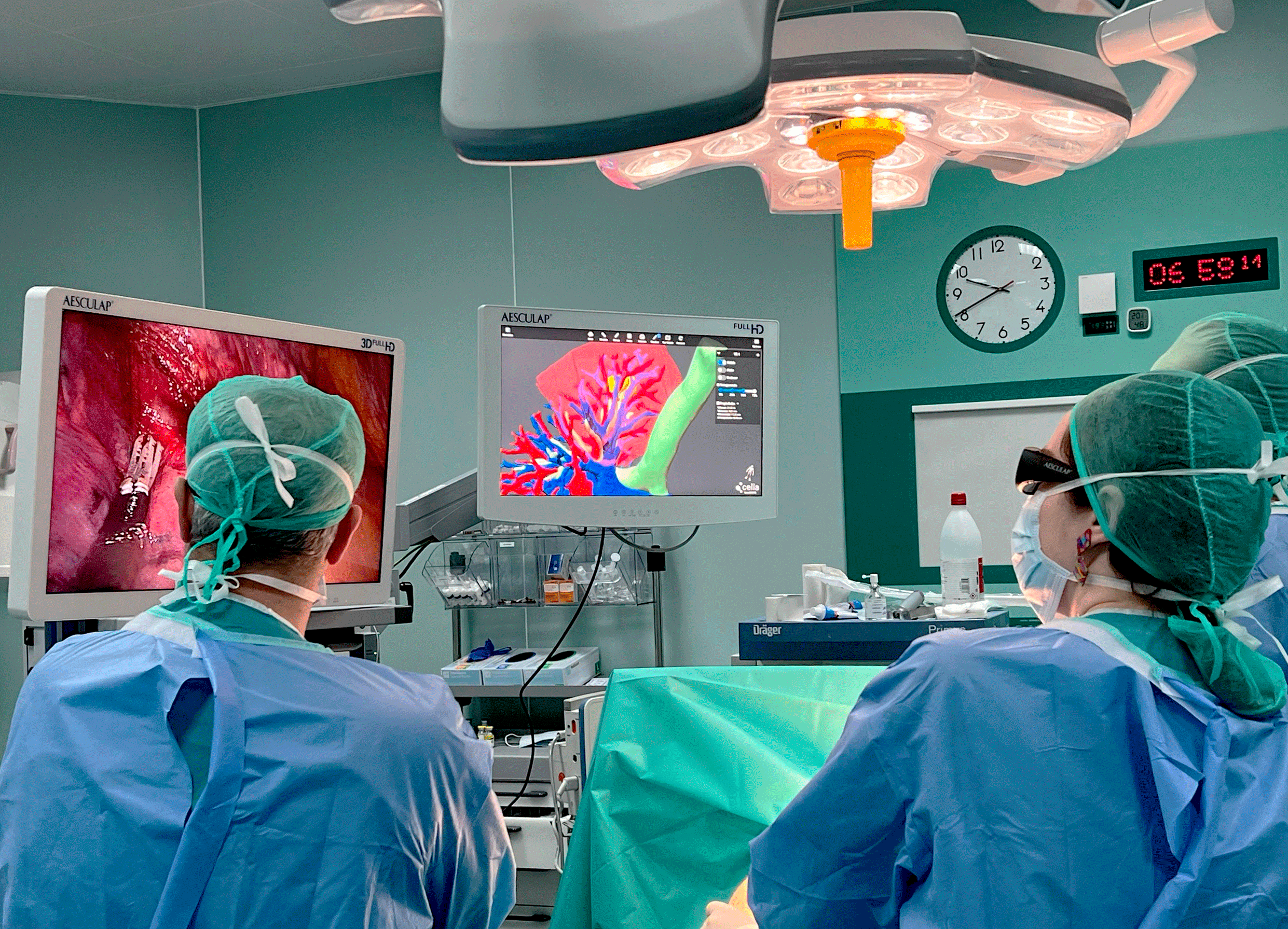 Modelos 3D en cirugía: Cella y B. Braun revolucionan las intervenciones laparoscópicas